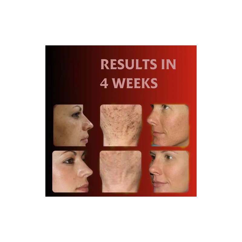 Crema Facial Despigmentante Y Aclarante 20g Todo Tipo De Piel