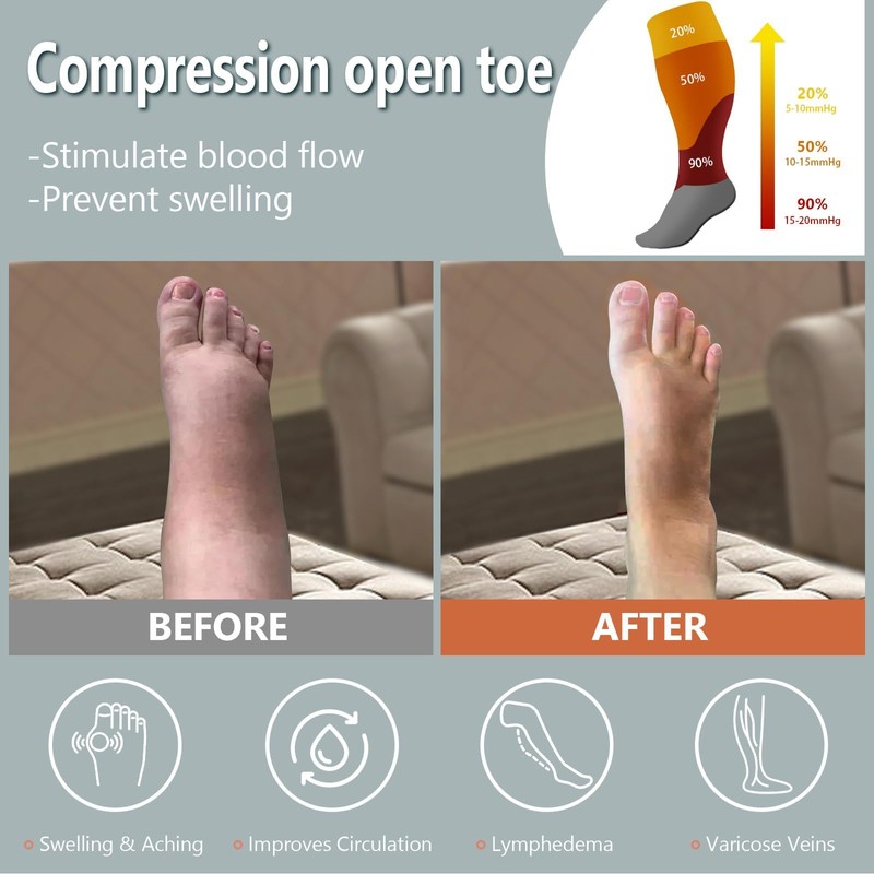 Abodhu Plus Size Compression Socks Open Toe Compression for Women&