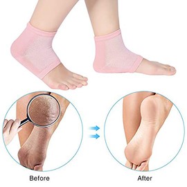 Calcetines de Talón de Gel Suave Calcetines Abiertos de Dedos para Piel Agrietada Dura Seca Piel Hidratante de Cuidado Nocturno(rosa)