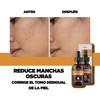 Purifect Brightening Vitamin C and Vitamin E Facial Serum, Softens