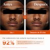 Sérum Facial de Vitamina C al 15% con Ácido Hialurónico