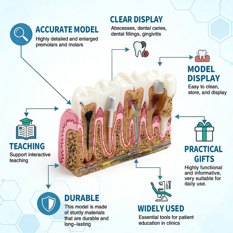 Dental Caries Tooth Anatomy Model Tooth Pathology Models Caries Evolution