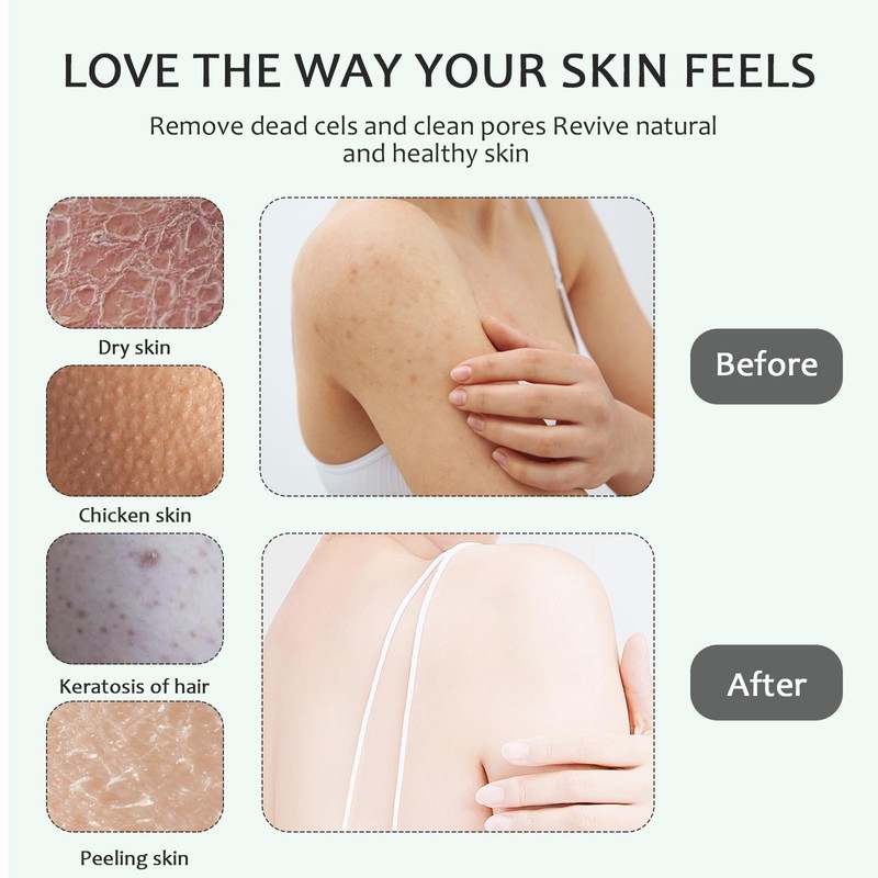 Exfoliating Gloves Pack of 4 Exfoliating Gloves, Body Exfoliating Gloves,