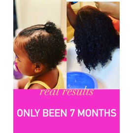 J’Organic Solutions Biotin Hair Growth Shampoo & Conditioner Set 12oz