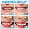 4 Pairs of False Teeth Veneers, Dentures Temporary Teeth, Safe