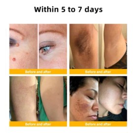 Crema Restauradora De Piel Vlsvls Con Bee Integral