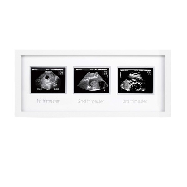 Pearhead Trimester Progression Sonogram Picture Frame, Pregnancy Milestone Keepsake Photo Frame, Gender-Neutral Baby Nursery Décor, Mother’s Day Accessory