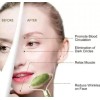 CB Rodillo De Jade Para Masaje Facial + Suero De