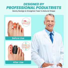 Aswalling Adjustable Hammer Toe Straightener Splints Wraps-4 Pcs Toe Corrector with Aluminum Plate Support for Men& for Women