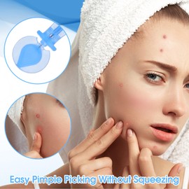 AOZUO 100PCS Disposable Blackhead Blemish Remover, Sterile Pimple Needles Pimple Popper Needles Tool for Acne, Whitehead, Closed Mouth Comedone Removal Clear Skin Suitable for Beauty Salon and Home