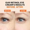 +1HEROLABS Retinol Eye Cream for Dark Circles and Puffiness, Anti