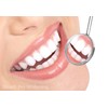 Teeth Whitening Gel Syringe Dispensers 22% Carbamide Peroxide, 10 Tooth