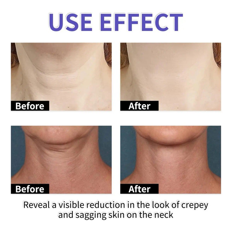 2x Neck Cream Tighten & Lift Firming, Neck Firming Cream