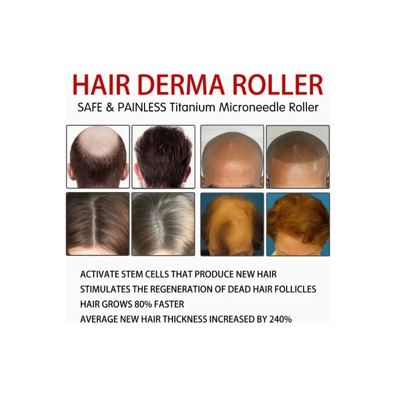 Dermaroller Barba Rodillo Facial Regenerador Aguja 0,5 Mm