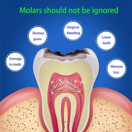 Samoka Mouth Guards for Clenching Teeth at Night Mouth Guard for Grinding Teeth Reus