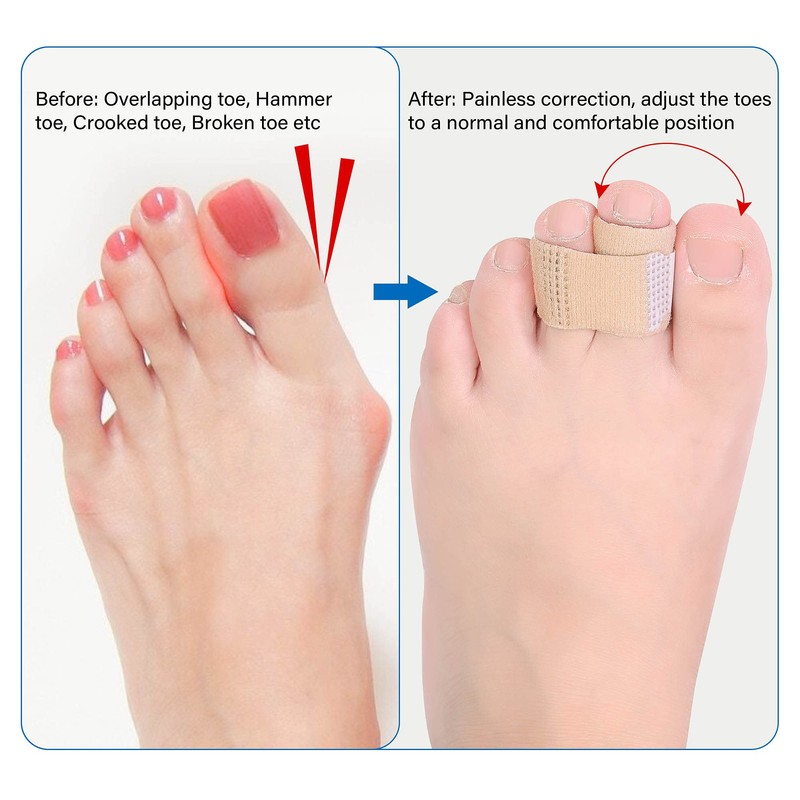 DYKOOK Broken Toe Wraps 8 Pcs/Pack Fabric Toe Splint Toe