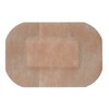 Alcare Delmapo Dressing No. 2 11992 Adhesive Wound Dressing, Box