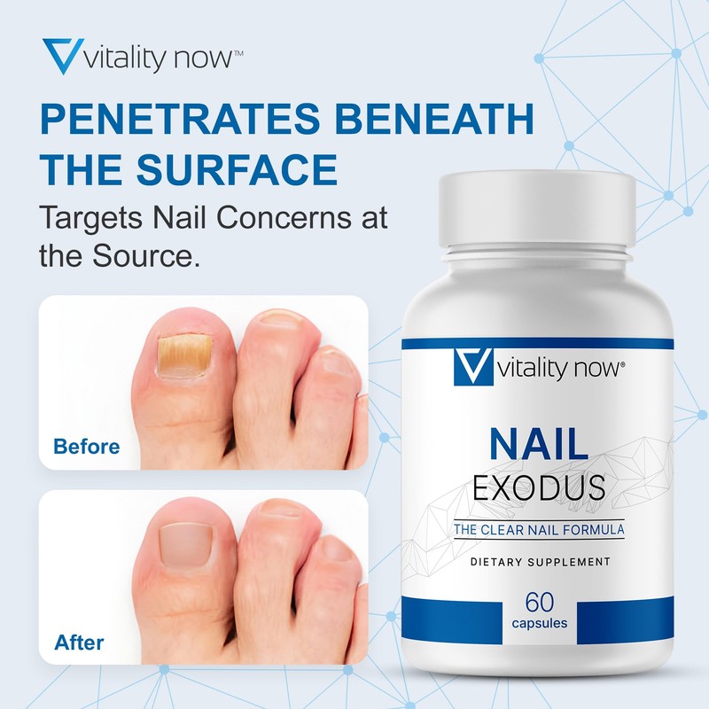 Nail Exodus - Vitality Healthy Nails - Premium Formula for