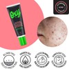 OXY Oxy Deep Pore Acne Vanishing Treatment - 5% Benzoyl