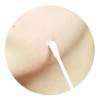 Neogen Loción Antiacné Vegana Hipoalergénica Con Ácido Salicílico 15mL