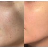 Suero Facial Blanqueador Extremo Kaliya Beauty - Fit Mr Madura