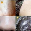 3 Kit Mascarilla & Jabón Carbón Activado / Puntos Negros