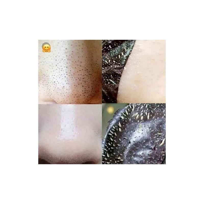 3 Kit Mascarilla & Jabón Carbón Activado / Puntos Negros