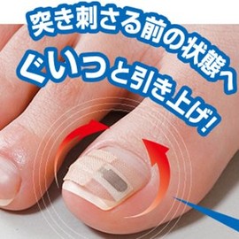Wound Nail Lift Seal for 2 Month Care; *Lift metal supports your nails.
