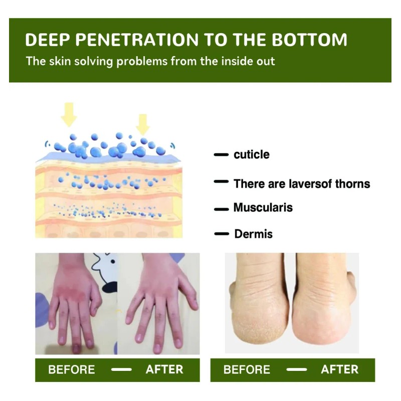 Crema Hidratante Para Pies Resecos Y Agrietados Moisturizing