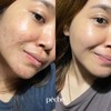 DIAMOND GLOW Collagen Skin Whitening Glowing Clear Acne Anti Aging
