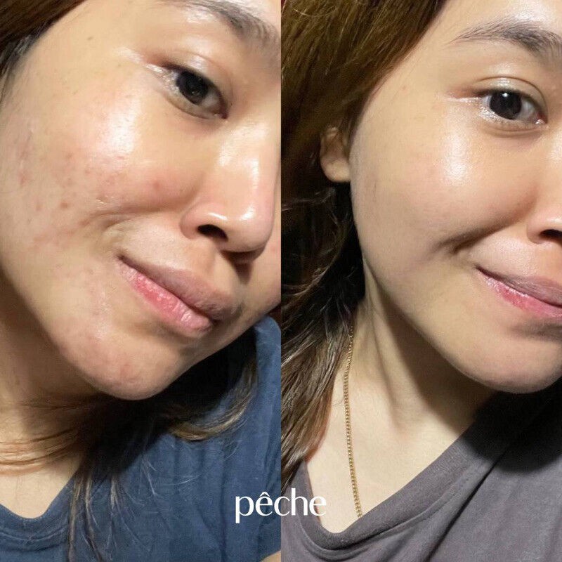 DIAMOND GLOW Collagen Skin Whitening Glowing Clear Acne Anti Aging