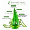 Gel Aloe Vera Bioaqua Blanqueamiento Quemaduras Hidrata
