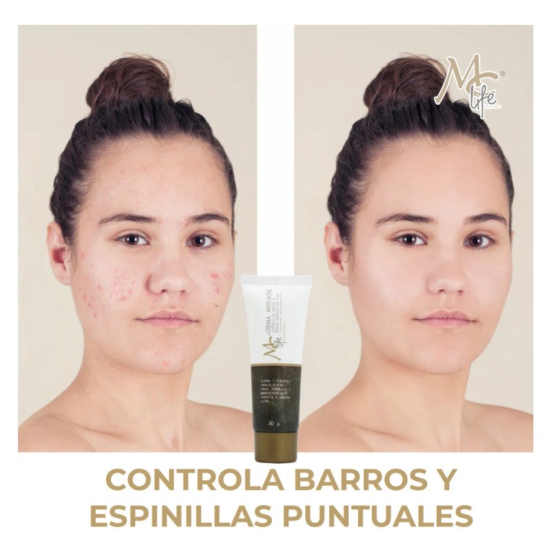 Crema Anti Acné Control Grasa Reduce Manchas Life Tipo Piel