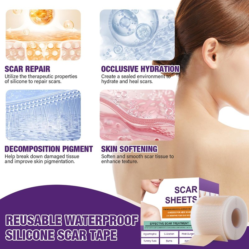Psecici 1.5M Advanced Silicone Scar Sheets Medical Grade for Keloid