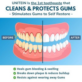 Gum Restore Toothpaste, Improves and protects damaged & bleeding gums, Breaks Down Plaque, Resists Tarter, Plant-based Formula, 99% Natural Ingredients, Free of Fluoride, Triclosan, Microbeads