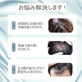 ynnyee Partial Wig, Men's, 100% Human Hair, Partial Wig, Men's, Hairpiece, Hand-Planted, Lightweight, Breathable, Artificial Skin, Imitation Thorl, Conceals Gray Hair, Hair Extension, Fluffy