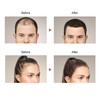 IMMETEE Hair Building Growth Fiber Kit Unisex Hair Thickener Denser