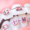 TrelaCo 1 Pack Fake Braces Artificial Tooth Decoration with Metal