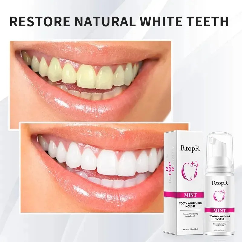 Mousse Espuma Blanqueador Dental Menta Cuidado Oral 60ml