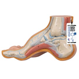 3B Scientific M32 Hollow Foot, Pes Cavus + free Anatomy App - 3B Smart Anatomy