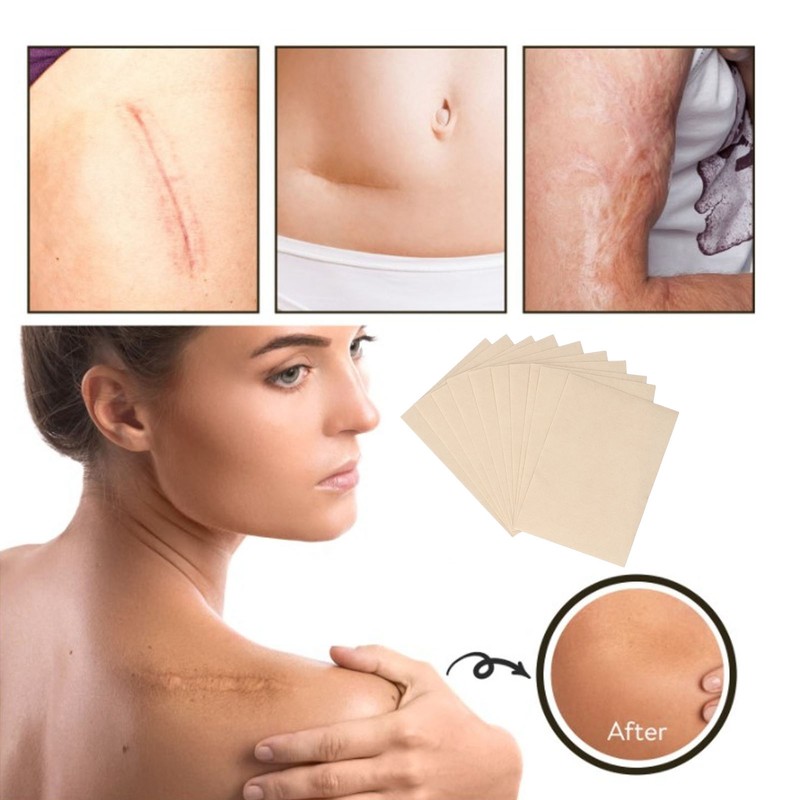 100PCS Flaw Conceal Sticker Low Sensitivity Invisible Birthmark Concealer Sticker
