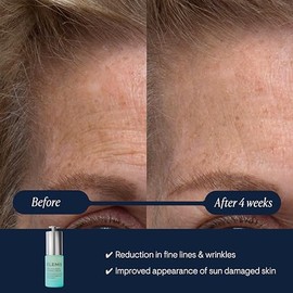ELEMIS Pro-Collagen Renewal Serum | Retinol Alternativo Concentrado Facial Rejuvenece, reafirma y reduce el aspecto de líneas finas y arrugas | 0.5 fl oz