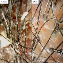 Briogeo Scalp Revival Soothe + Detoxify Hair Care Minis Kit, Soothe a Dry, Flaky, Itchy Scalp, Vegan, Phalate & Paraben-Free, Travel Kit