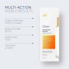 Dove Suero Concentrado para Estrías, Manchas y Elasticidad con Niacinamida,