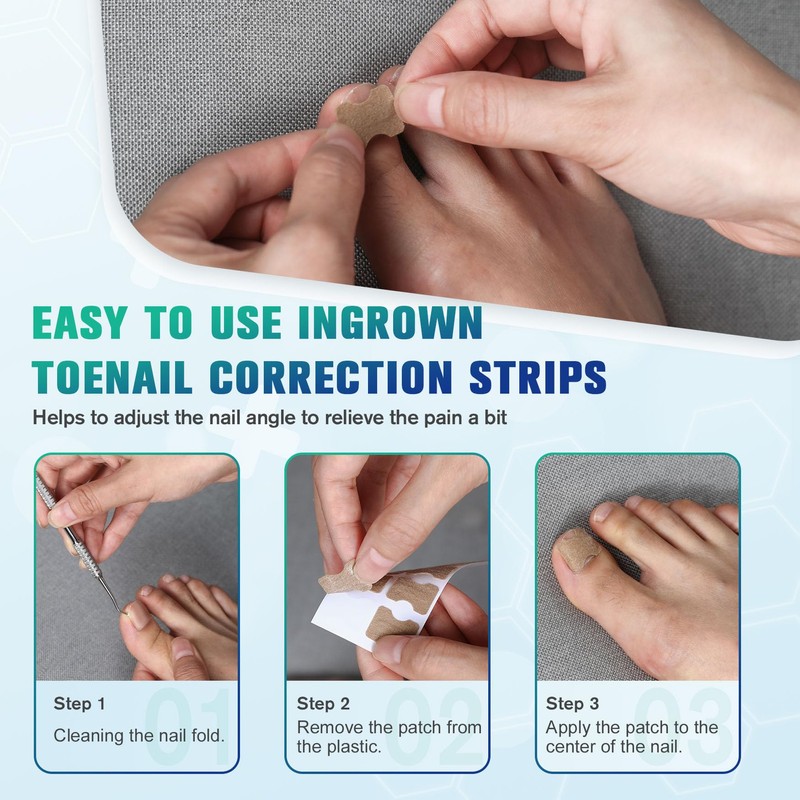FERYES 50 PCS Breathable Ingrown Toenail Corrector Patch with Double-Ended