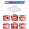 YONGDING Dental Resin Fitting Beads Teeth Repair Kit for Temporary