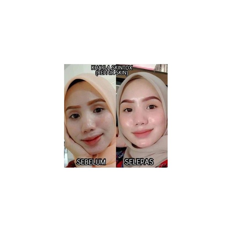 KRIM MALAM REPAIR SKIN BY KHAYLA BEAUTY