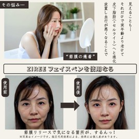 ZIREE Face Trigger Point Pointer, Spring Type, Facial Beautifying Device, Stiffness, Myofascial Release, Face Line, Bear, Eye Care, Facial Muscles, Lift, Quiet Design, Face, Ear Trigger Point, Unisex