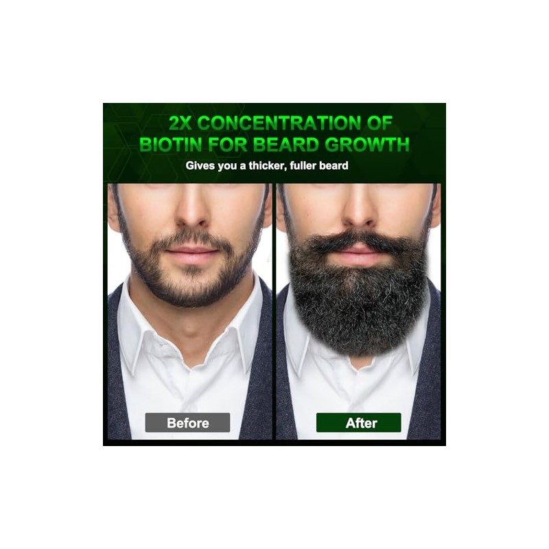 Bálsamo Barba Engrosamiento Biotina Estilos Crecimiento Fortalece Suaviza Barbas Bigotes
