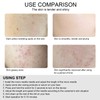 Professional Derma Pen Micro Needle 3 Gears Adjustment Anti Aging
